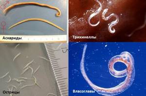 Все виды паразитов в организме человека (классификация)