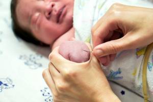 Диабетическая фетопатия у новорожденных и плода у беременных